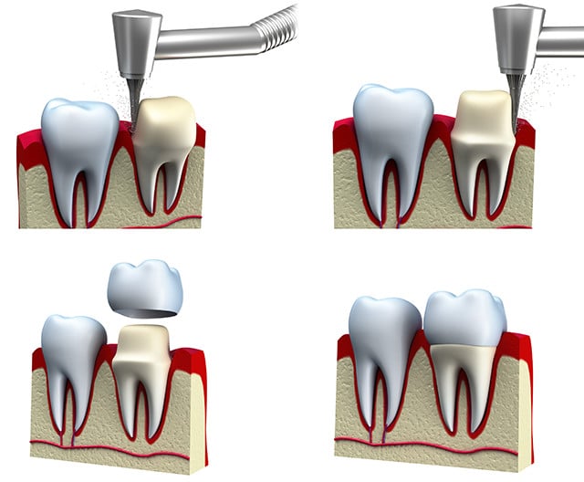 crowns-illustration