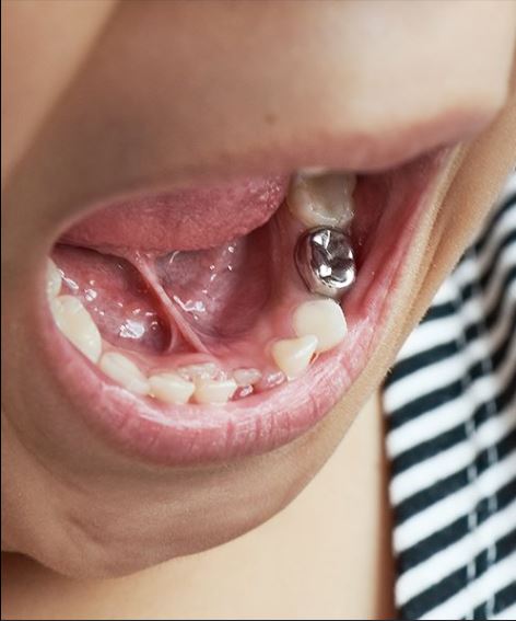 | Cornerstone Family Dentistry